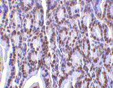 Anti PHAP I Antibody (PrecisionAb Polyclonal Antibody) gallery image 2