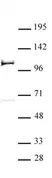 Anti Human PHF20 Antibody thumbnail image 1
