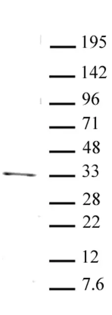Anti Human PITX2 Antibody gallery image 1