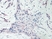 Anti Human Platelet Factor-4 Antibody thumbnail image 1