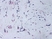 Anti Human Platelet Factor-4 Antibody thumbnail image 3