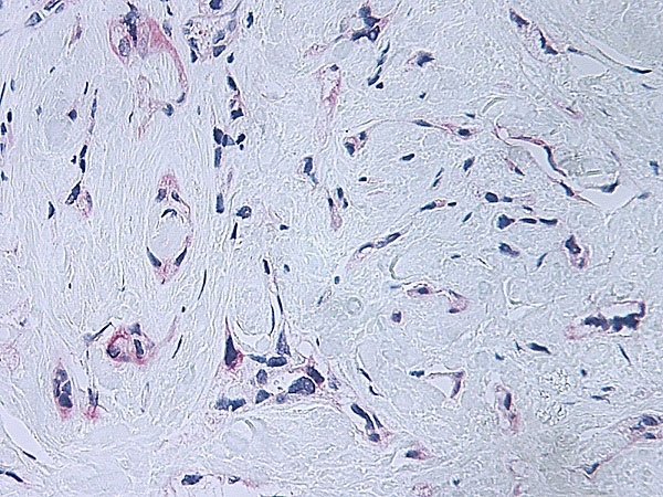 Anti Human Platelet Factor-4 Antibody gallery image 3
