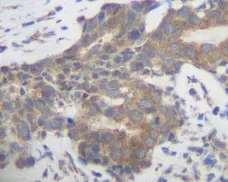 Anti Human PLGF Antibody gallery image 1