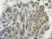 Anti Human PLGF Antibody thumbnail image 2