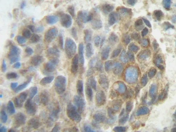 Anti Human PLGF Antibody gallery image 2