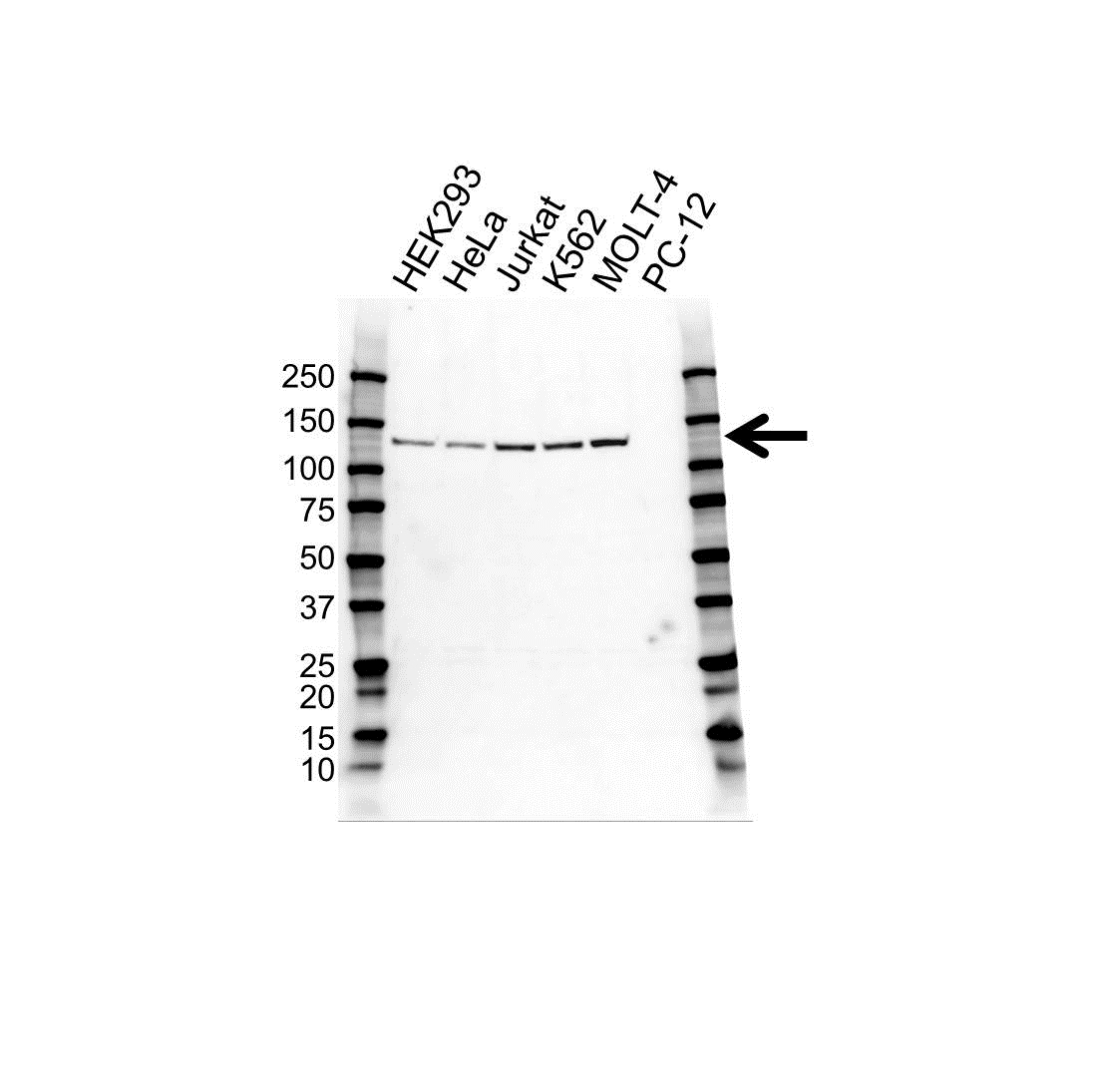 Anti POLD1 Antibody (PrecisionAb Polyclonal Antibody) gallery image 1