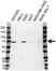 Anti Poly (ADP-Ribose) Polymerase 3 Antibody (PrecisionAb Polyclonal Antibody) thumbnail image 1