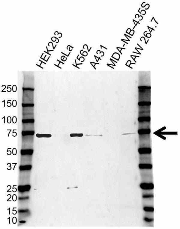 Anti Poly (ADP-Ribose) Polymerase 3 Antibody (PrecisionAb Polyclonal Antibody) gallery image 1