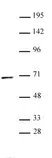 Anti Human PPM1D Antibody thumbnail image 1