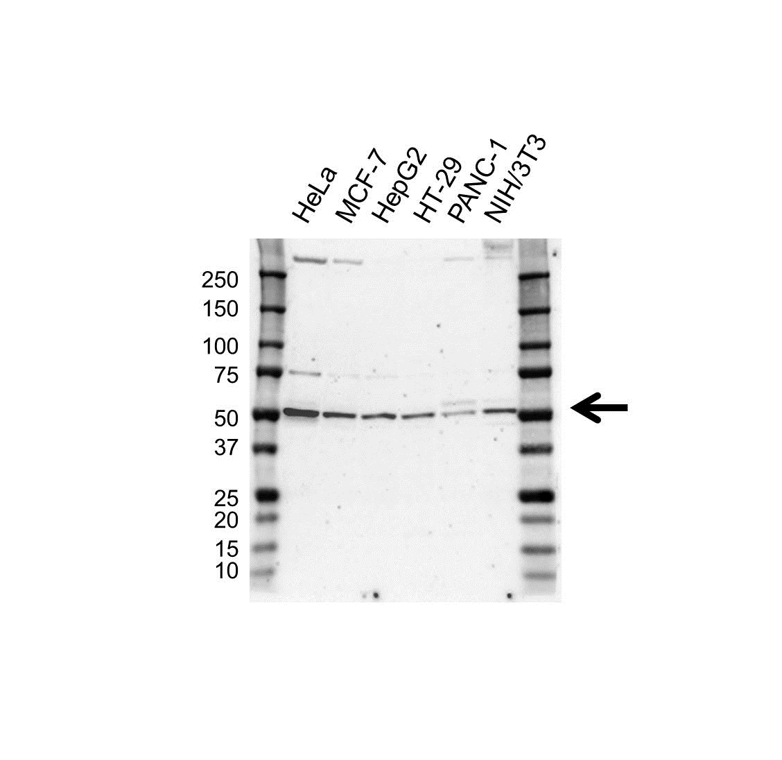 Anti PPP2R2A Antibody (PrecisionAb Polyclonal Antibody) gallery image 1