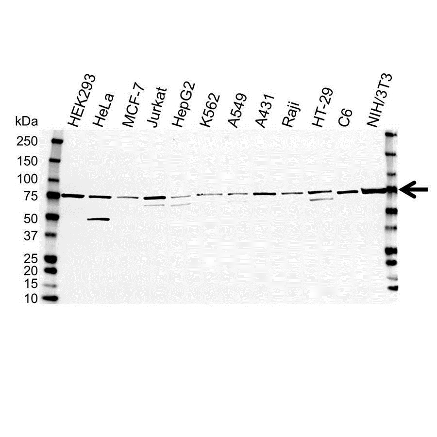 Anti PPP2R5D Antibody (PrecisionAb Polyclonal Antibody) gallery image 1
