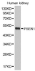 Anti Presenilin-1 Antibody thumbnail image 1
