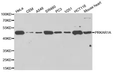 Anti PRKAR1A Antibody gallery image 1