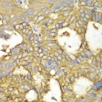 Anti PRKAR1A Antibody gallery image 2