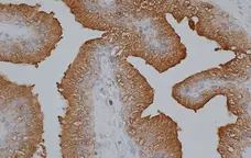 Anti Human Prostate Specific Antigen Antibody gallery image 1