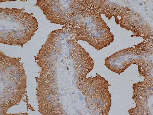 Anti Human Prostate Specific Antigen Antibody gallery image 1