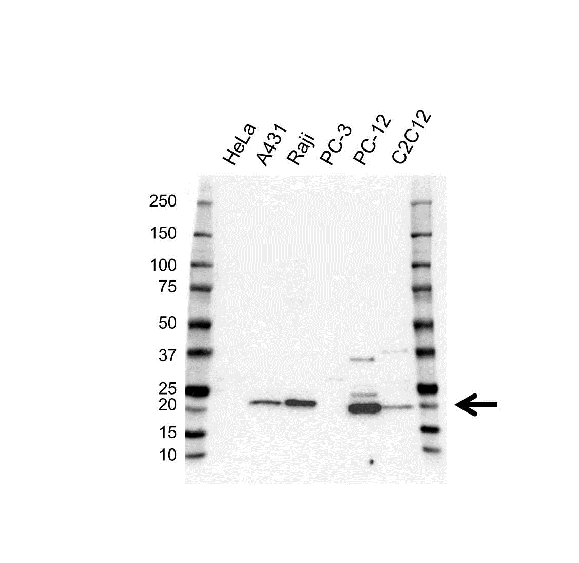 Anti PSMB9 Antibody (PrecisionAb Polyclonal Antibody) gallery image 1