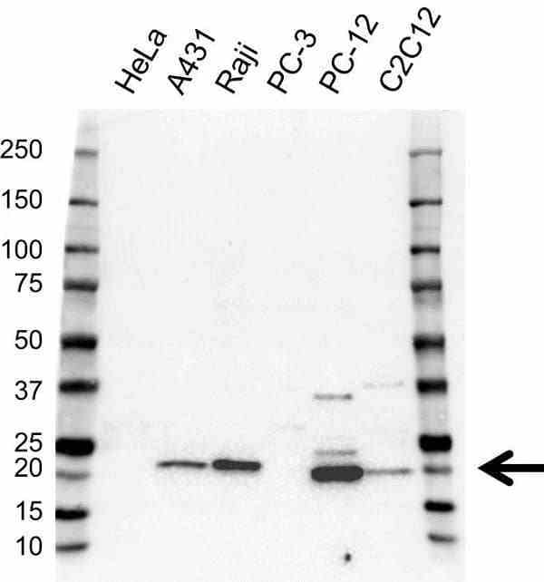 Anti PSMB9 Antibody (PrecisionAb Polyclonal Antibody) gallery image 2