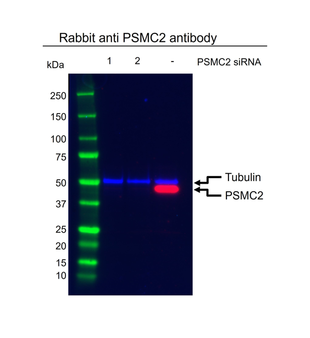 Anti PSMC2 Antibody (PrecisionAb Polyclonal Antibody) gallery image 2