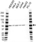 Anti PSMD4 Antibody (PrecisionAb Polyclonal Antibody) thumbnail image 1