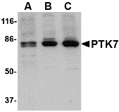 Anti Human PTK7 (N-Terminal) Antibody gallery image 1