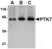 Anti Human PTK7 (N-Terminal) Antibody thumbnail image 1