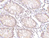 Anti Human PTK7 (N-Terminal) Antibody gallery image 2