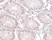 Anti Human PTK7 (N-Terminal) Antibody thumbnail image 2