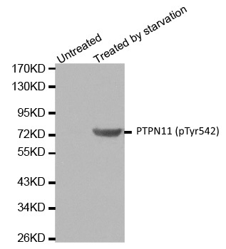 Anti PTPN11 (pTyr542) Antibody gallery image 1