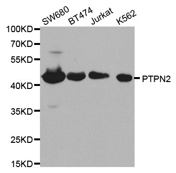 Anti PTPN2 Antibody gallery image 1