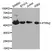Anti PTPN2 Antibody thumbnail image 1