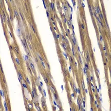 Anti PTPN2 Antibody gallery image 2