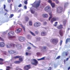 Anti PUMA Antibody gallery image 1