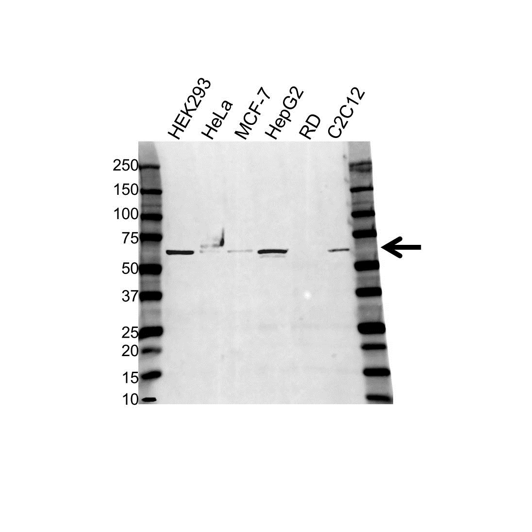 Anti Pyruvate Kinase Pkm Antibody (PrecisionAb Polyclonal Antibody) gallery image 1