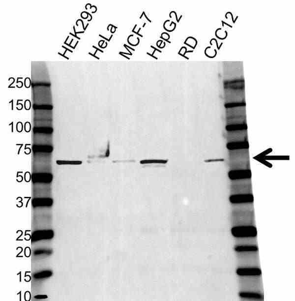 Anti Pyruvate Kinase Pkm Antibody (PrecisionAb Polyclonal Antibody) gallery image 1