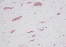 Anti Human RANTES Antibody gallery image 1