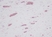 Anti Human RANTES Antibody thumbnail image 1
