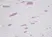 Anti Human RANTES Antibody thumbnail image 1