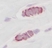 Anti Human RANTES Antibody thumbnail image 2