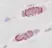 Anti Human RANTES Antibody thumbnail image 2