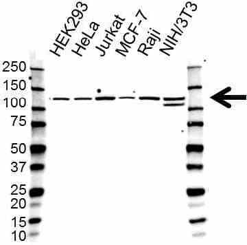 Anti RE1-SILENCING Transcription Factor Antibody (PrecisionAb Polyclonal Antibody) gallery image 1