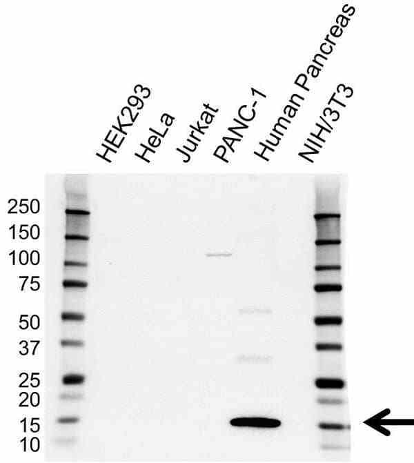 Anti REG1A Antibody (PrecisionAb Polyclonal Antibody) gallery image 2