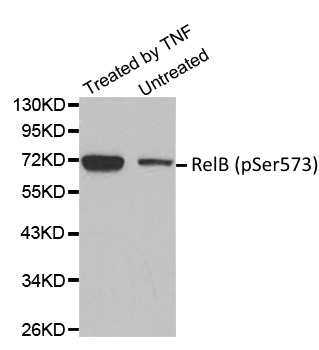 Anti RelB (pSer573) Antibody thumbnail image 1
