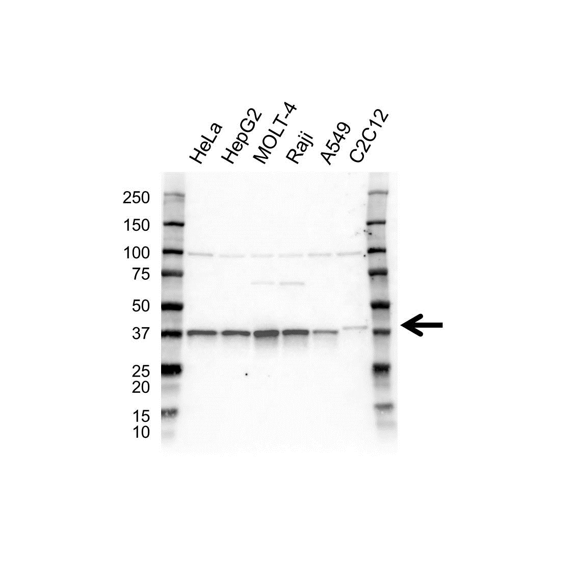 Anti Replication Factor C Subunit 4 Antibody (PrecisionAb Polyclonal Antibody) gallery image 1