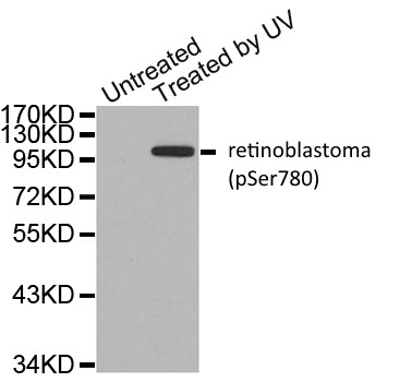 Anti Retinoblastoma (pSer780) Antibody gallery image 1