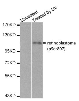 Anti Retinoblastoma (pSer807) Antibody gallery image 1