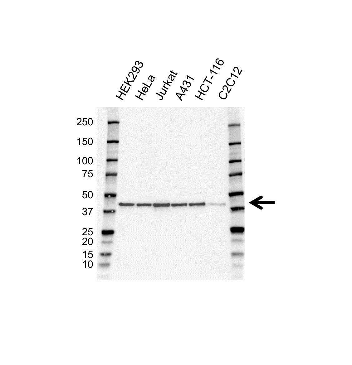 Anti Ribosomal Protein Sa Antibody (PrecisionAb Polyclonal Antibody) gallery image 1
