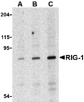 Anti RIG-I Antibody thumbnail image 1