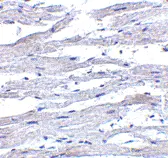 Anti RIG-I Antibody gallery image 2
