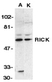 Anti RIP2 (N-Terminal) Antibody thumbnail image 1